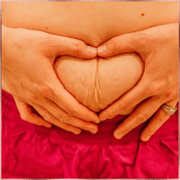 postpartum-body-stretch-marks-on-belly-flab