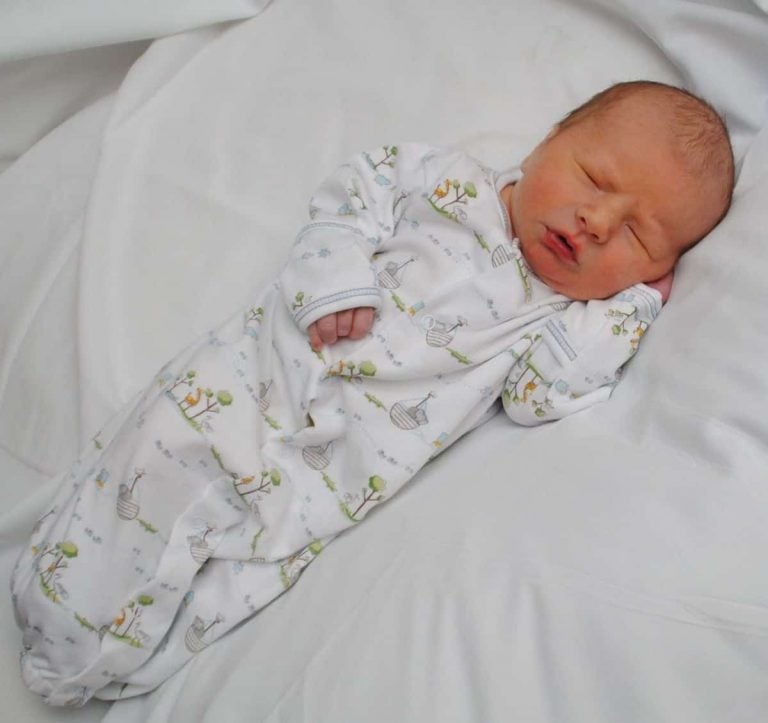 Feeding Infants (Newborns) with Recessed Chin (Micrognathism)