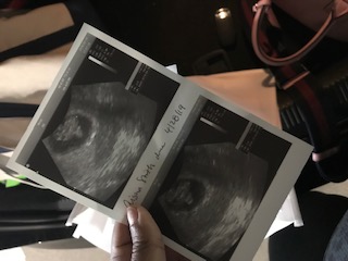 hand-holding-ultrasound-photo