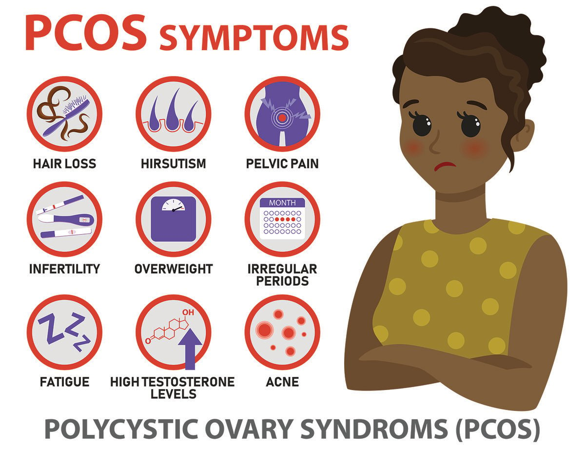 infographic that details the symptoms of PCOS