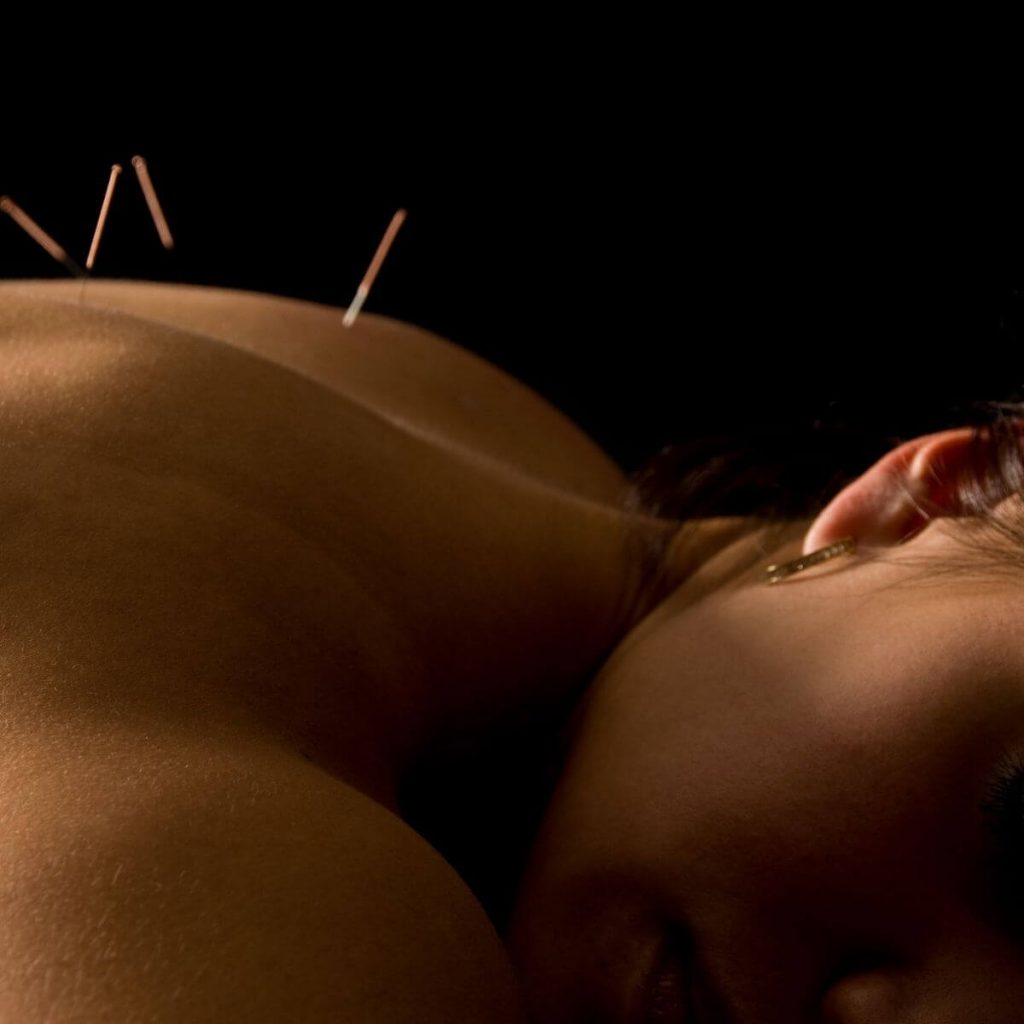 Acupuncture for fertility back
