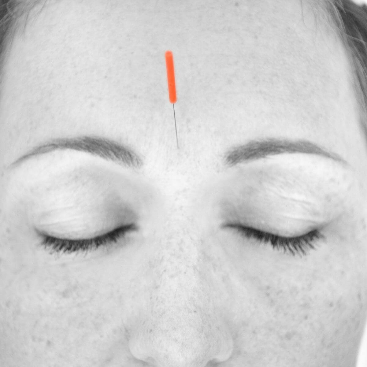 acupuncture for fertility header