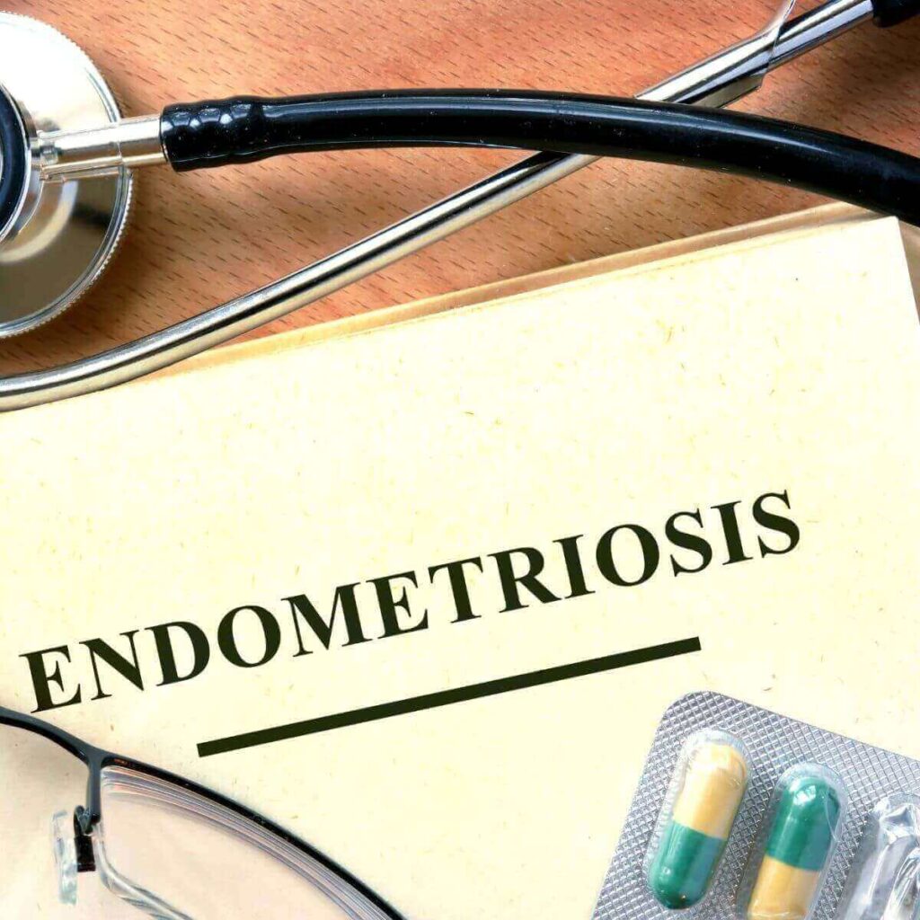On a light brown table sits a stethascope, a pair of glasses, green and white pills, and a paper with the word Endometriosis at the top.